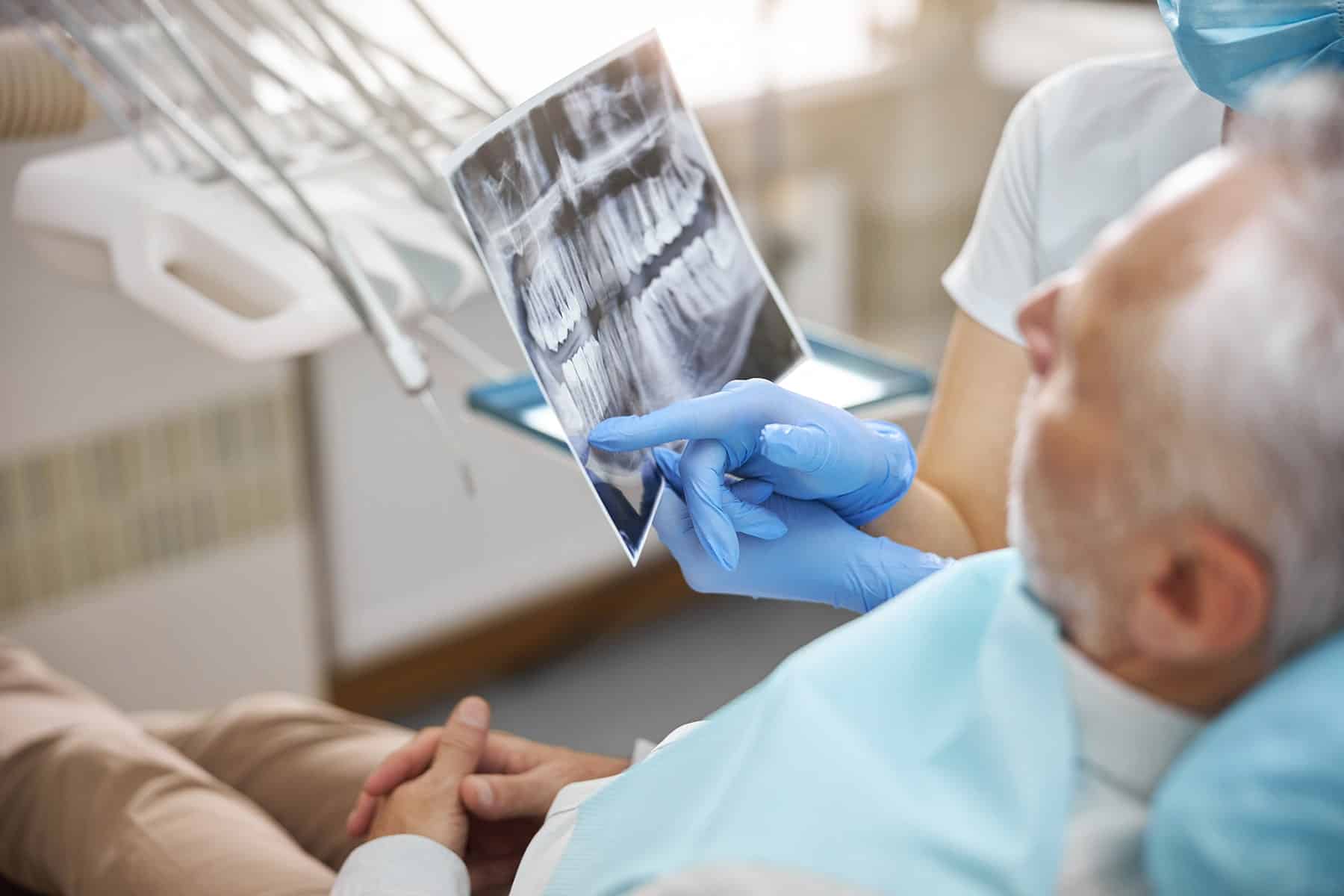 Denture implants in El Paso, TX
